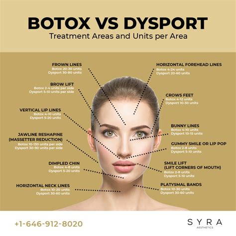 dysport vs botox which lasts longer.